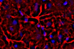 Astrocyte web