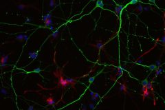 Differentiating Neurospheres