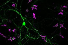 MicroGlial attack