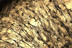 Golgi stained hippocampus