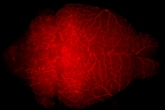 This is your brain on dii