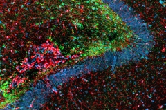 Neuroinflammation in the monkey hippocampus