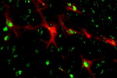 Perineuronal nets in the human post-mortem brain