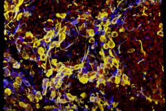 Human brain organoids
