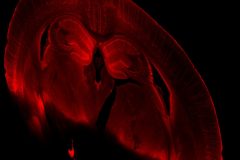 Brain slice of an Thy1-YFP-H transgenic mouse after iDISCO method