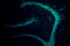 Fluorescent NeuN stain in hippocampus