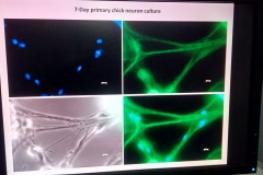 7-DIV primary neuron culture