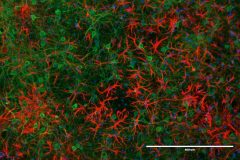 Neurons and Glia(astrocytes) in Primary Mouse Cortical Cell