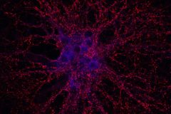 Cortical Neuron Cluster in Vitro