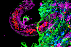 Perinatal infection in the monkey brain