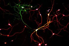 Interneuron axon shot