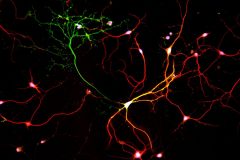 Interneuron axon shot