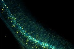 Neuronal micro-circuit mapping in the hippocampus