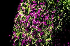 Astrocyte distribution in medial habenula (MHb)