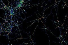 Modeling neurodegeneration with human stem cell derived i3 neurons