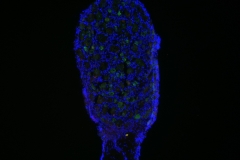 The portrait of a dorsal root ganglion