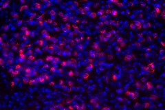 Lewy bodies in mouse olfactory structures