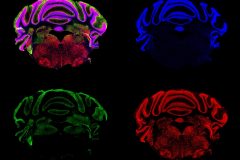 The beauty brain. coronal brain section including the cerebellum (upper part) of 6 months old mouse, stained for nuclei (DAPI, blue), parvalbumin (green) and the oxidative stress marker (8-oxo-dG, red).