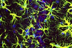 Astrogliosis in the Hippocampus of an Epileptic Mouse