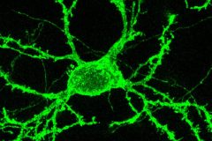 Hippocampal spiny neuron