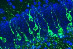 Newborn neurons