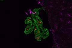 Choroid plexus with neurons and microglia