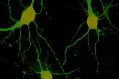 Neuritogenesis