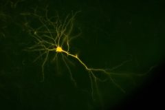 The majestic neuron