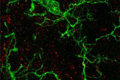 Microglial turf war in the auditory midbrain