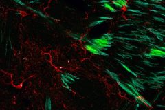 Microglial Pathway