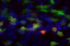 Phagocytic microglia in the neonatal brain
