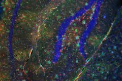 Snapshot of Interaction Between Astrocytes and Blood Vessels in the Hippocampus of an Alzheimer's Mouse Brain