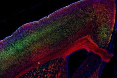Neurofilament-heavy and myelin staining in the mouse frontal cortex and striatum