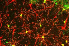 Immunofluorescence of NG2 and SOX10 in Mouse Hippocampus (40x)