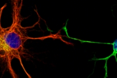 Neural progenitors in culture