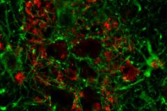 Alzheimer spiderweb