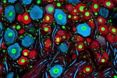 Small and large neurons in the dorsal root ganglion