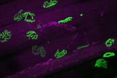 Neuromuscular garden