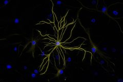GFAP Staining of an Astrocyte