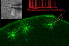 Neuron crossed fingers