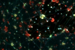 Neurons with bubbles