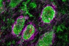  Perineuronal Nets in the Cerebellar Nuclei