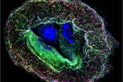 Cortical neuro-prerrogative