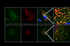 Modulation of mitochondrial dynamics in enteric cell