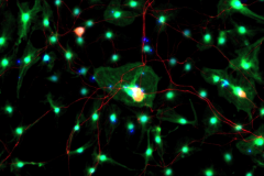 Dissociated dorsal root ganglia neurons