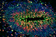 Proliferative ventricle-like structure in cerebral organoids