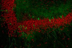 New Neurons Take Root