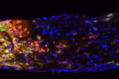 Inflammatory cells respond to optic nerve injury.