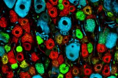 Distribution of isolectin B4 (IB4, red), calcitonin gene related peptide (CGRP, green) and NF 200 (blue) labeled neurons in the rat dorsal root ganglion.