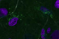 Feels like home (one confocal plane)